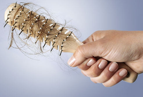 الأسباب الأكثر شيوعا لتساقط الشعر عند المرأة